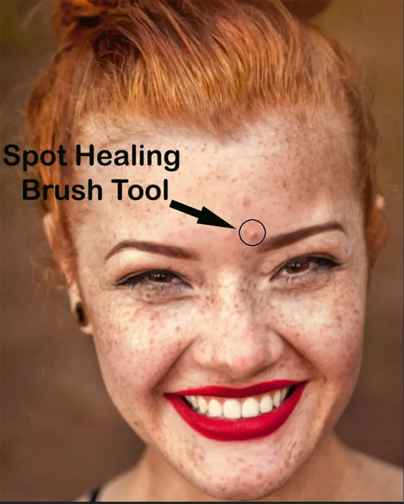 Remove Blemishes